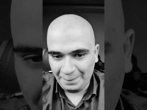 چی شد که کچل کردم؟