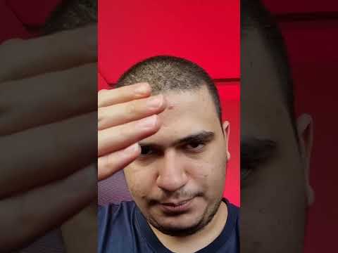 ببین چی شده💀
